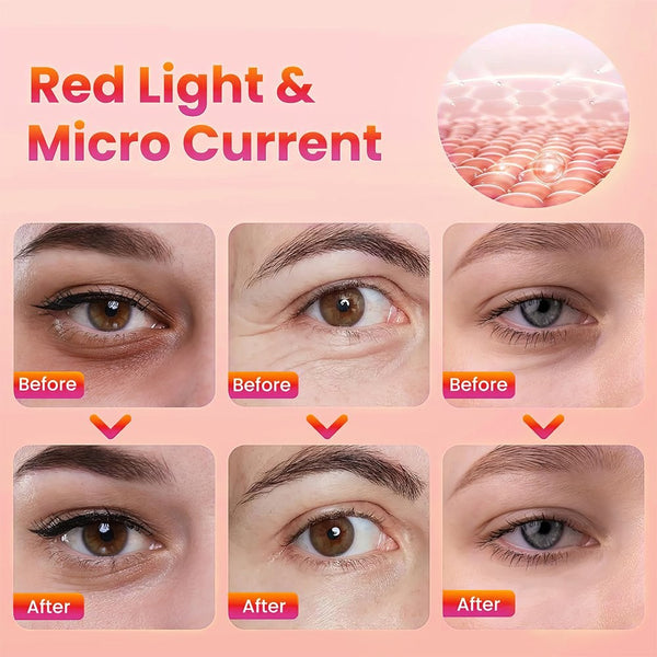 Under-Eye Red Light Therapy 